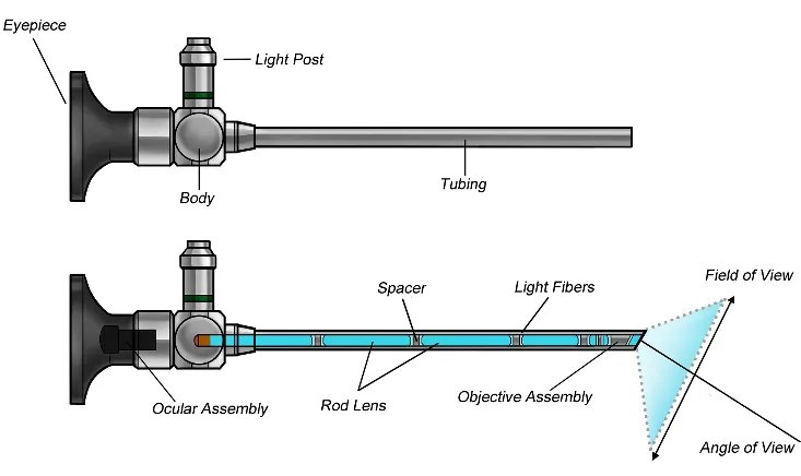 Classification and Application of Endoscope Classification and Application of Endoscope